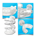 shopify-38539256168609 Dispositif avancé anti-ronflement - Ozerty